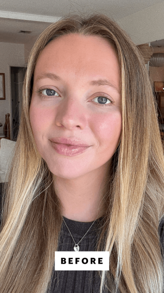 Fowler before applying the Rare Beauty True to Myself Tinted Pressed Finishing Powder